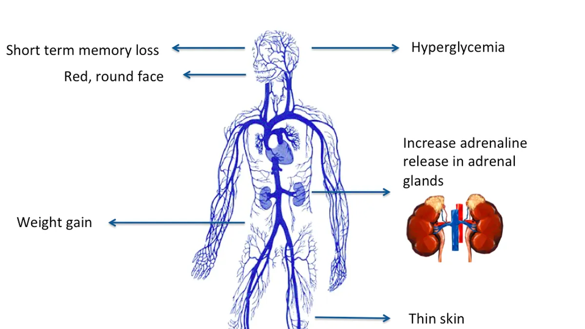 All you need to know about: Cushing&rsquo;s syndrome