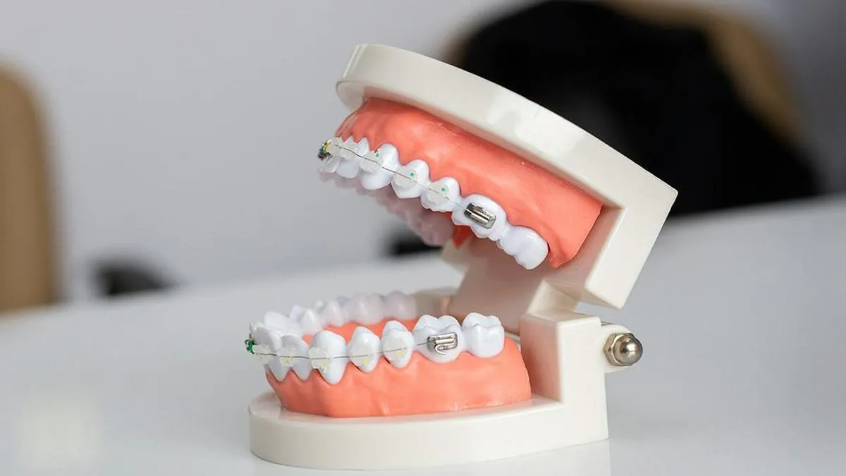 Experts call attention to health and developmental impact of overbite and underbite