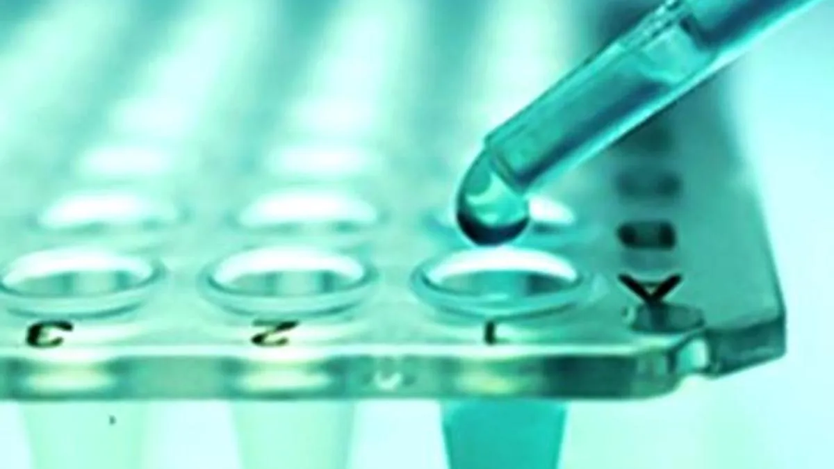 Why finding a stem cell match remains a major challenge for patients with aplastic anaemia